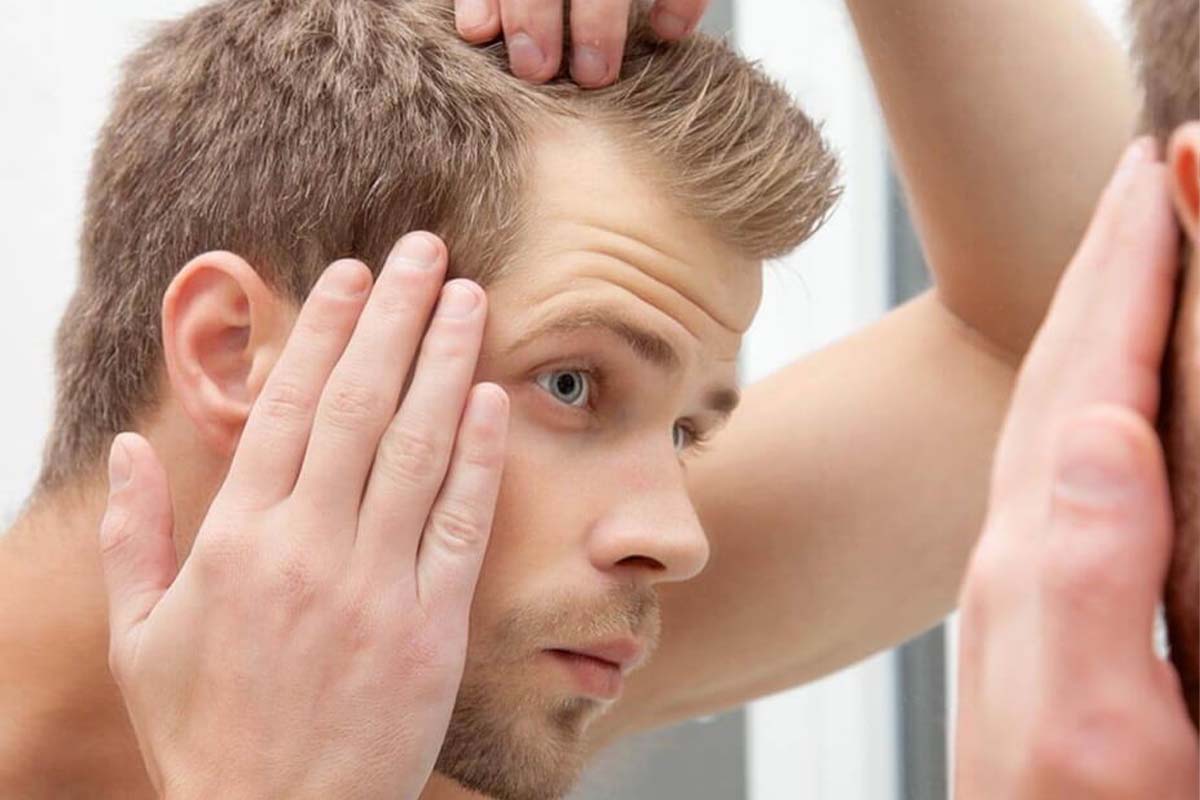 Hair Transplant